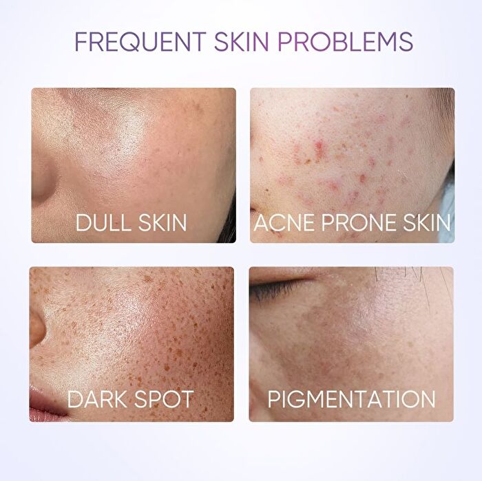 Skintific Symwhite 377 Dark Spot Serum - 20ml