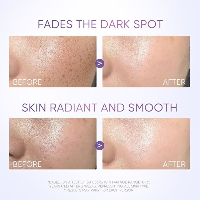 Skintific Symwhite 377 Dark Spot Serum - 20ml