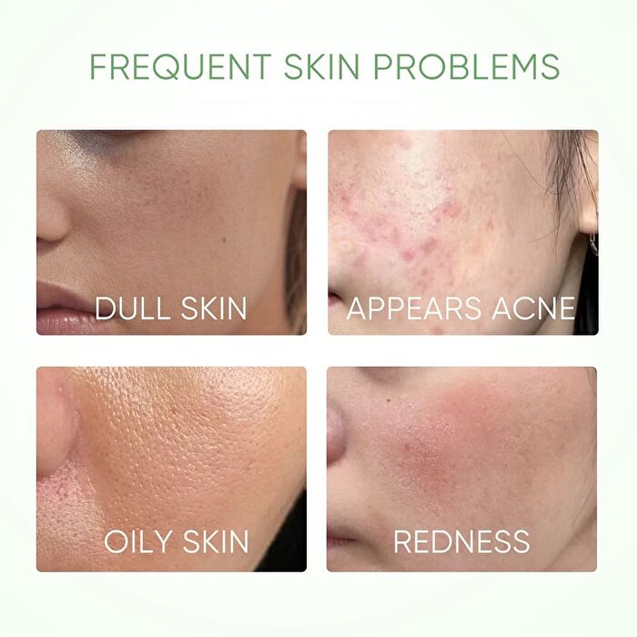 Skintific Mugwort Acne Clay Stick - 40g