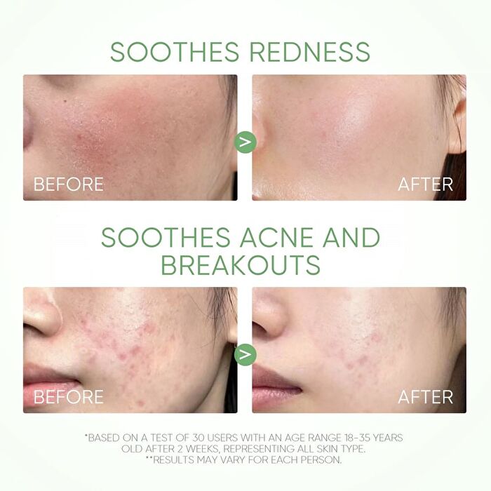 Skintific Mugwort Acne Clay Stick - 40g
