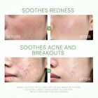 Skintific Mugwort Acne Clay Stick - 40g