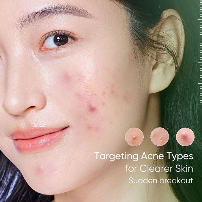 Skintific Acne Drying Lotion - 10ml