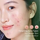Skintific Acne Drying Lotion - 10ml