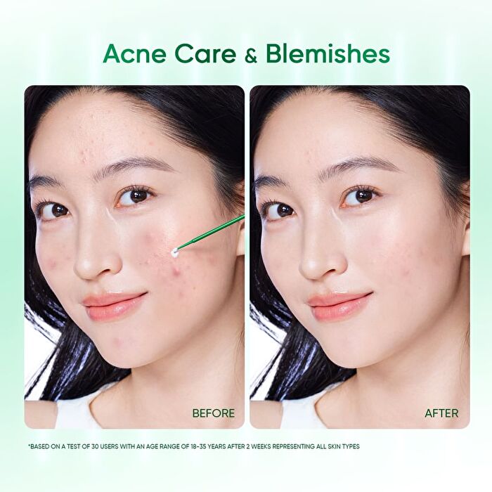 Skintific Acne Drying Lotion - 10ml