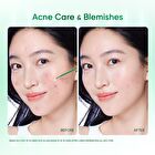 Skintific Acne Drying Lotion - 10ml