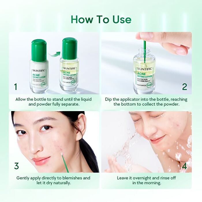 Skintific Acne Drying Lotion - 10ml
