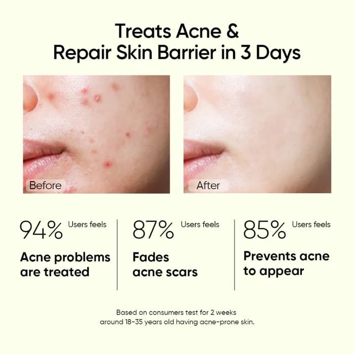 Skintific 2% Salicylic Acid Anti Acne Serum - 20ml