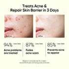 Skintific 2% Salicylic Acid Anti Acne Serum - 20ml