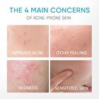 Skintific 5% Panthenol Acne Calming Water Gel - 45g