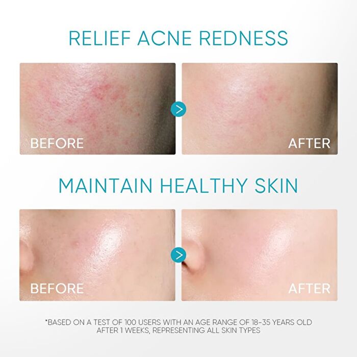 Skintific 5% Panthenol Acne Calming Water Gel - 45g