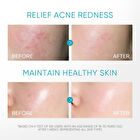 Skintific 5% Panthenol Acne Calming Water Gel - 45g