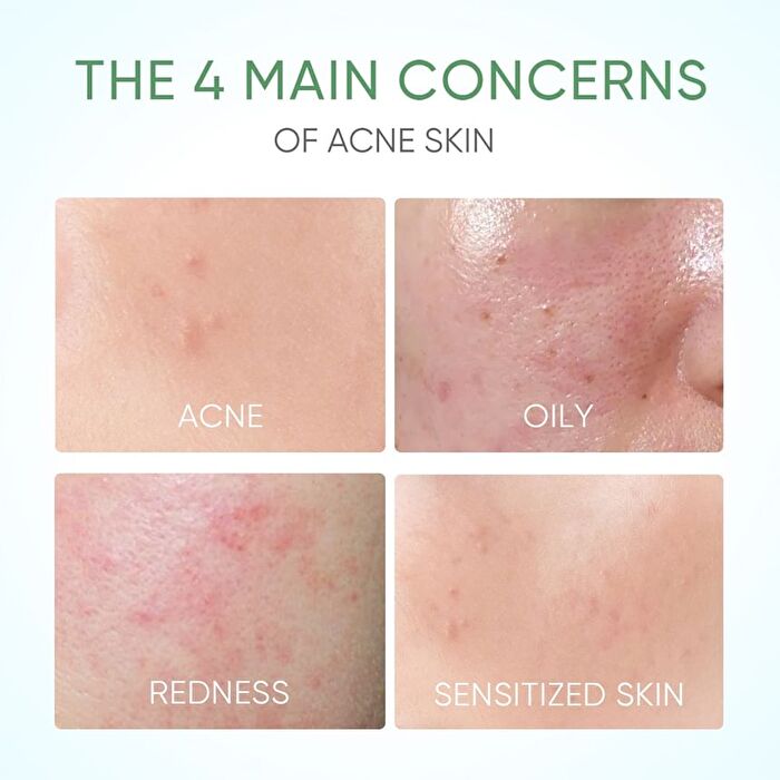 Skintific Pure Centella Acne Calming Toner - 80ml