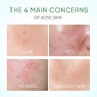 Skintific Pure Centella Acne Calming Toner - 80ml