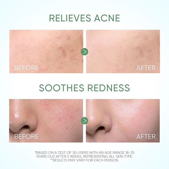 Skintific Pure Centella Acne Calming Toner - 80ml
