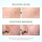 Skintific Pure Centella Acne Calming Toner - 80ml