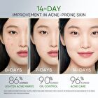 Skintific 3X Acid Anti-Acne Gel Moisturizer - 30g