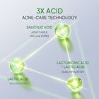 Skintific 3X Acid Anti-Acne Gel Moisturizer - 30g