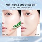 Skintific 3X ACID Intensive Acne Spot - 11g