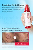 Hypochlorous Acid Daily Facial Spray - 125ml