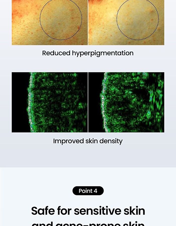 Cica PDRN Skin Booster Serum - 30ml