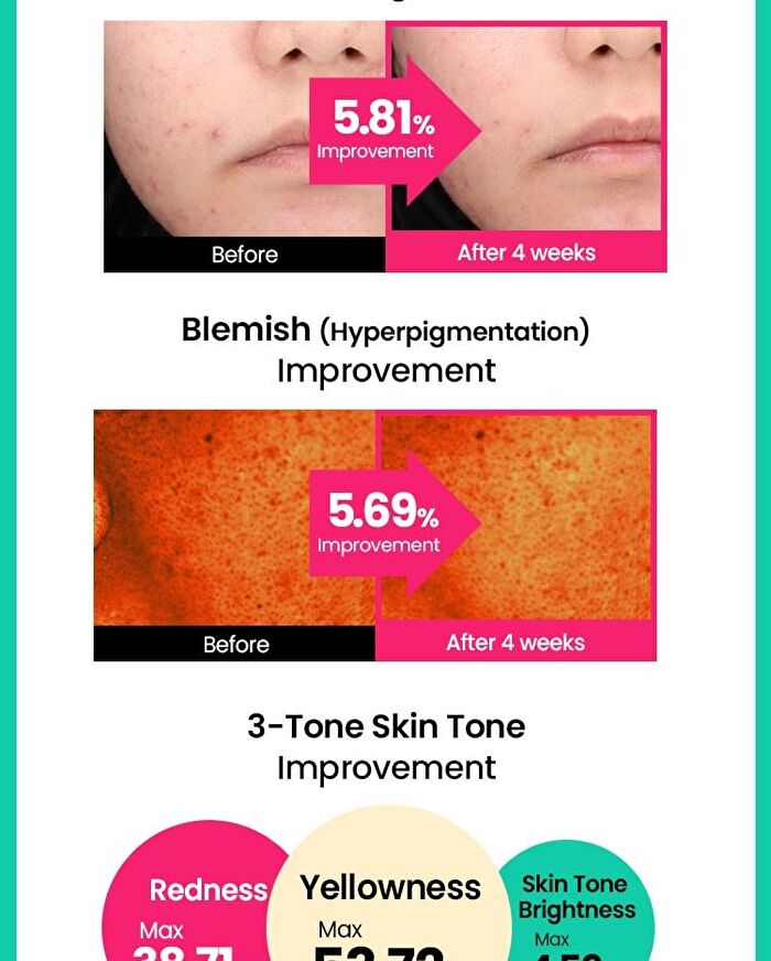 Cicaterol Blemish Pad Mini - 10 pads