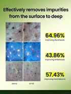 Mung Bean Pore Clearing Filter Pad - 70 pads