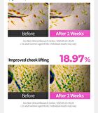 Ring Collagen 20 Return Serum - 35ml