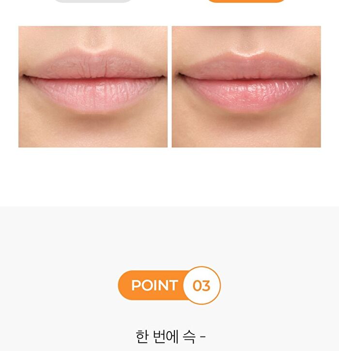 Moist Lip Protector - 10g
