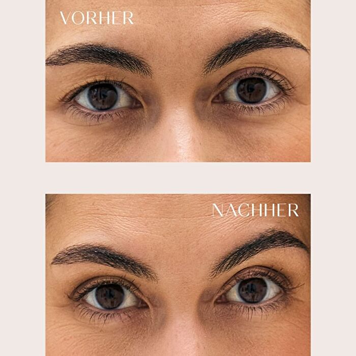 Anti-Slip Double Eyelid Tapes - White