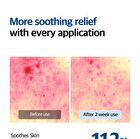 Blue Eraser Spot - 5ml