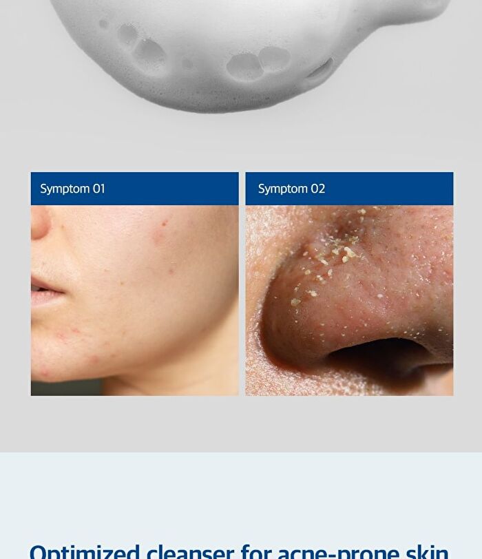Blue Eraser Cleanser - 80ml