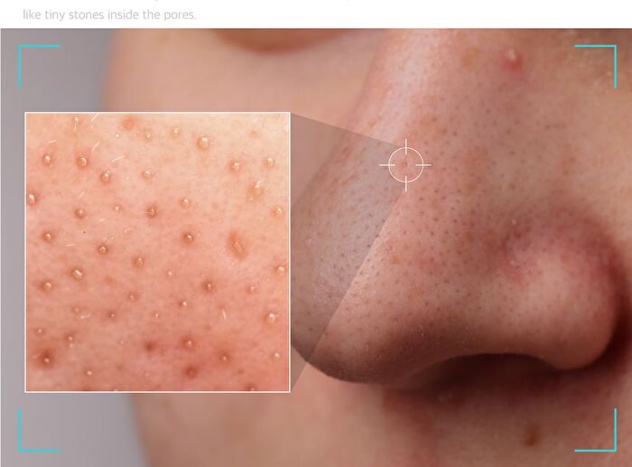 Pore Shot Zero Pack - 0.5g x 8 sheets