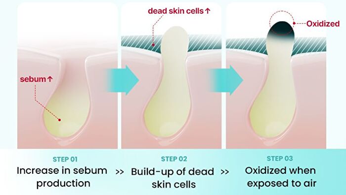 Super Melting Sebum Cleansing Oil - 2025 Version - 200ml