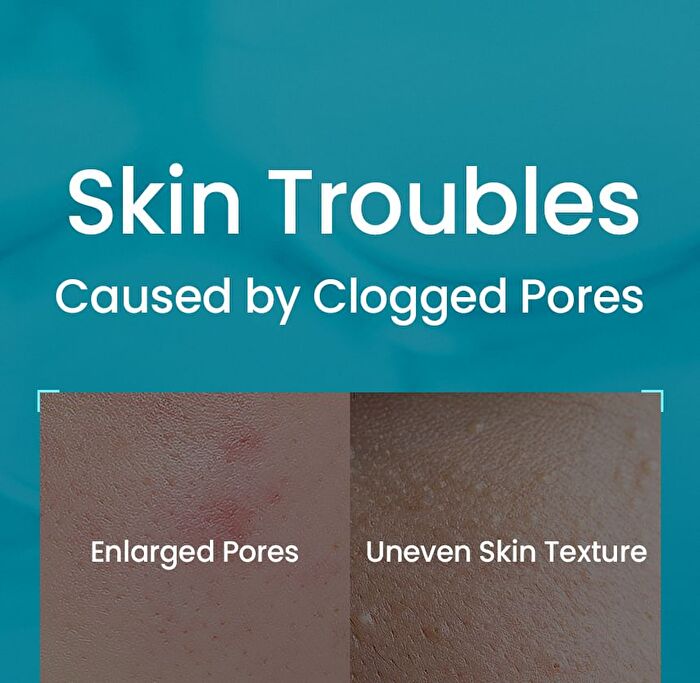 Pore Cleansing Master - 1 pc