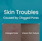 Pore Cleansing Master - 1 pc