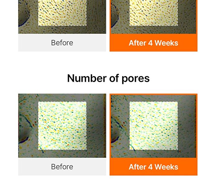 Vitamin PDRN Bouncy Pore Serum - 35ml