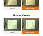 Vitamin PDRN Bouncy Pore Serum - 35ml