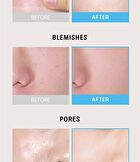 Braye Nano Corrector - 6 Colors - Sora