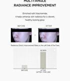 SKIN1004 Lab in Nature Madagascar Centella Niacinamide 10 Boosting Shot Ampoule Mini - 9ml