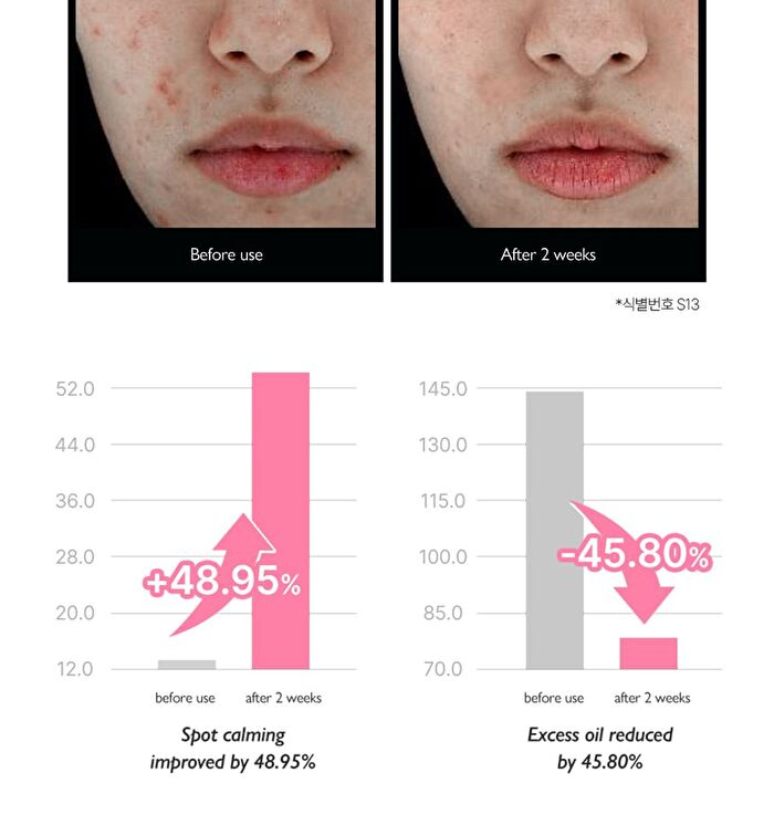 Pink Calamine Spot Care Powder - 15ml