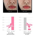 Pink Calamine Spot Care Powder - 15ml