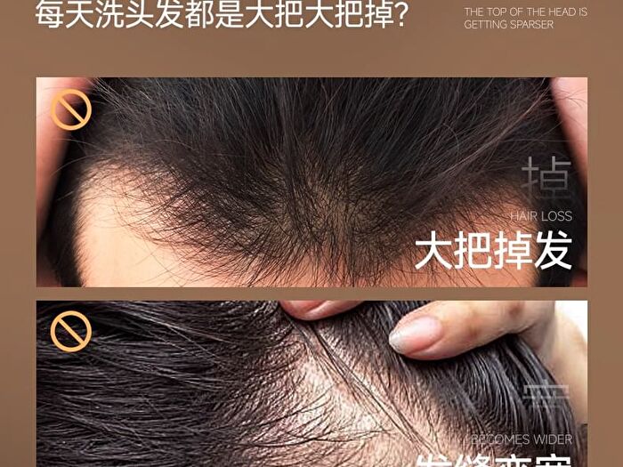 Mancodes Anti-Hair Loss Shampoo - 300ml