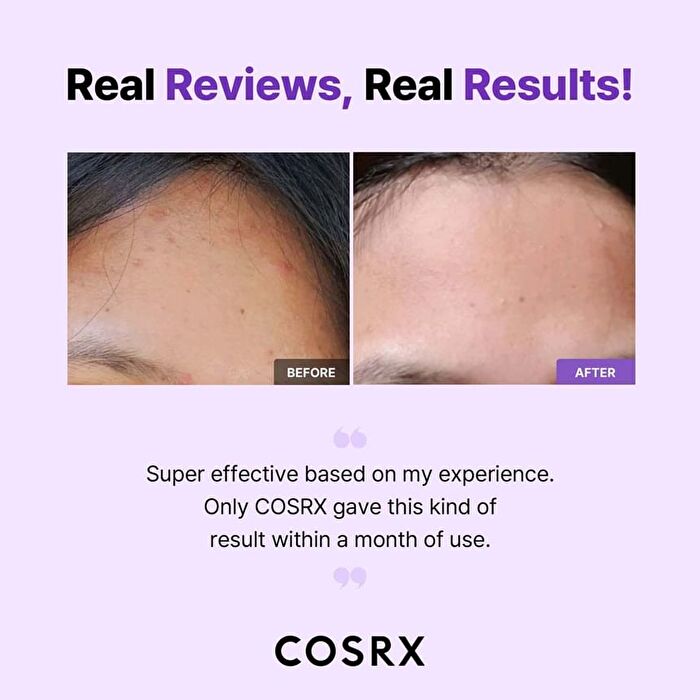 AHA/BHA Clarifying Treatment Toner Trial - 30ml