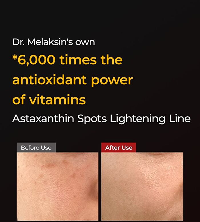 TX-Astaxanthin Brightening Serum - 2025 Winter Version - 30ml