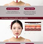 Nmode Pro Pink Edition - 1 set