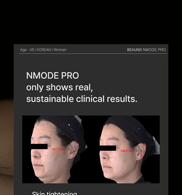 Nmode Pro Pink Edition - 1 set