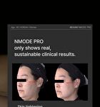 Nmode Pro Pink Edition - 1 set