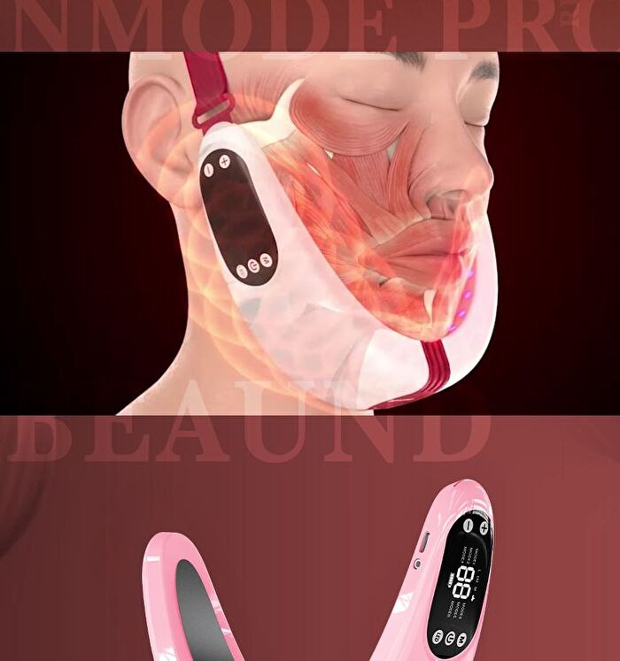 Nmode Pro Pink Edition - 1 set