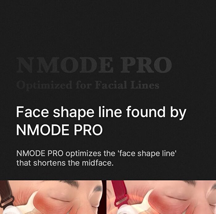 Nmode Pro Pink Edition - 1 set