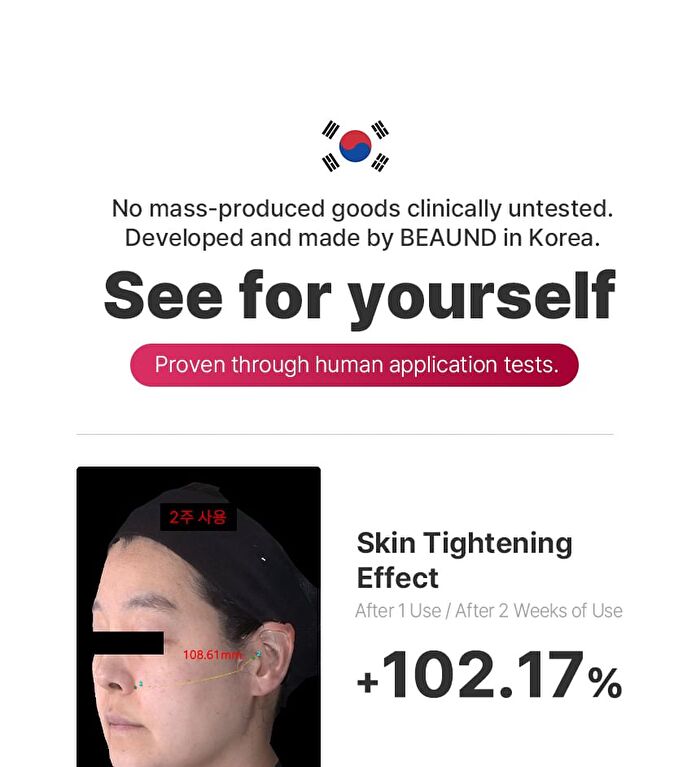 Nmode Pro Pink Edition - 1 set